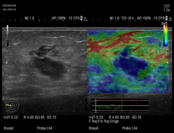 Эластография молочных желез в Могилеве